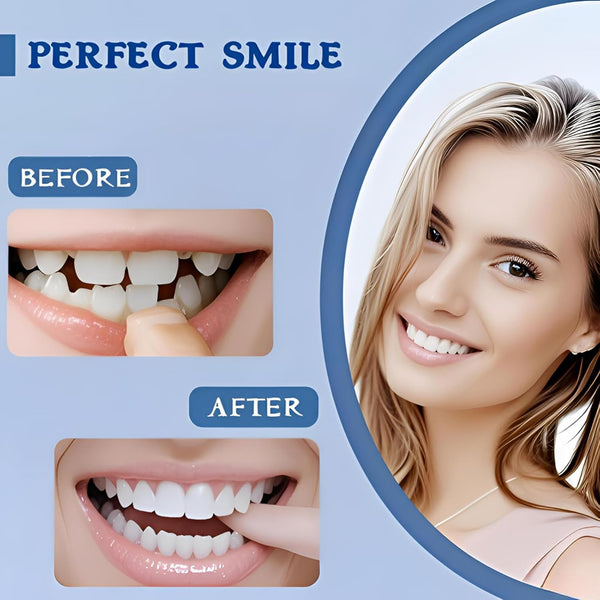Set 2 Fațete GreatSmile - Potrivite pentru oricine are nevoie de o soluție rapidă!