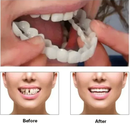 Set 2 Fațete GreatSmile - Potrivite pentru oricine are nevoie de o soluție rapidă!